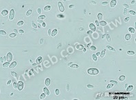 為鑑別酵母菌種類，利用顯微鏡觀察酵母菌形態多呈卵圓形或橢圓形，細胞較一般細菌大。