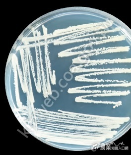 不同酵母菌具有不同形態，為鑑別酵母菌種類，於培養基純化並觀察，左圖酵母菌菌落為米白色，周圍產生假菌絲；右圖菌落圓滑微凸，表面光亮。