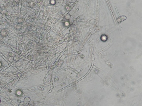 圖4__病原菌產生圓形孢囊。