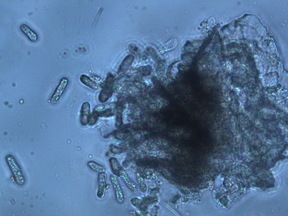 圖12__病原菌柄子殼內之分生孢子。