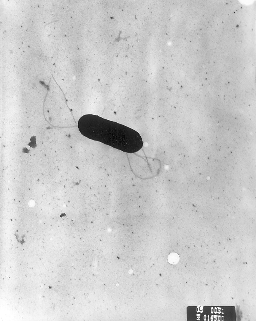 Listeria_monocytogenes李斯特菌_(2)