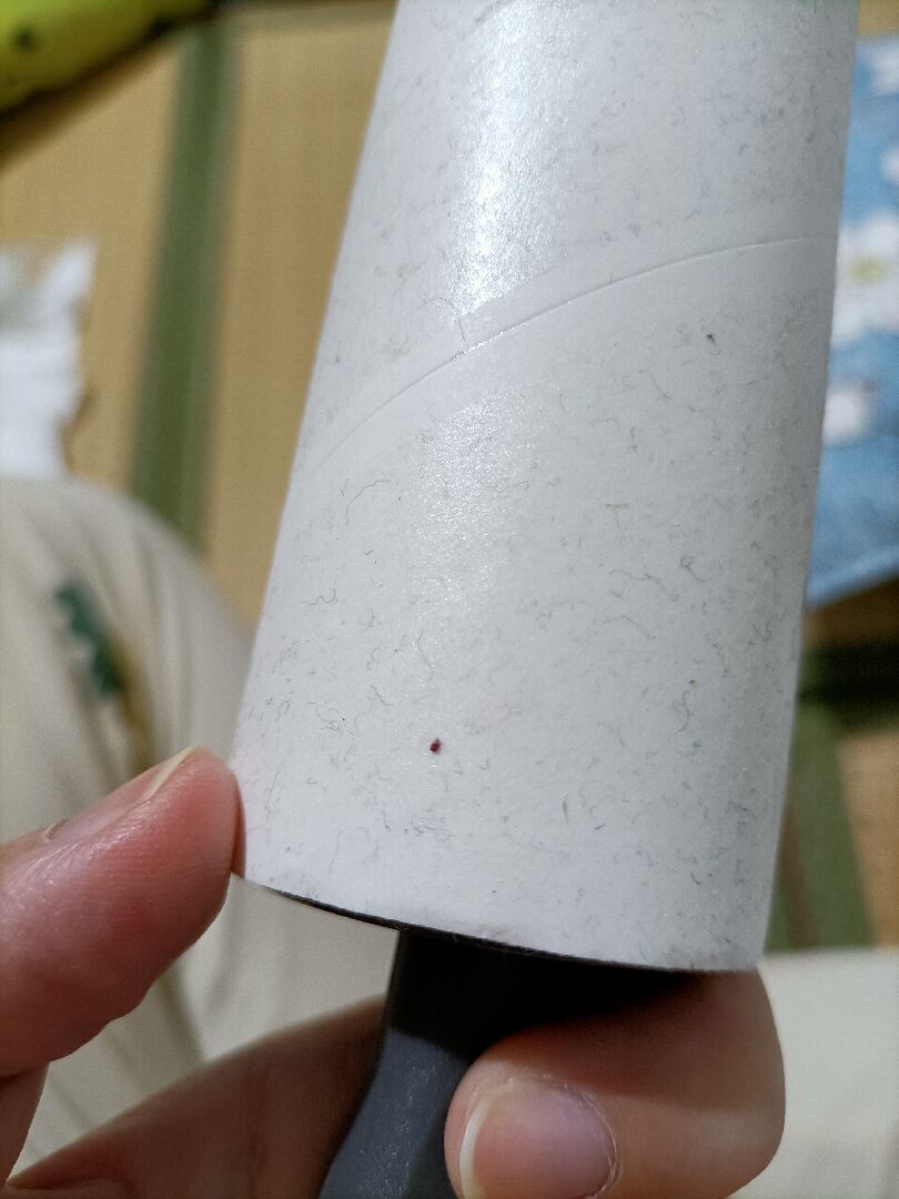 請問這是禽蟎嗎